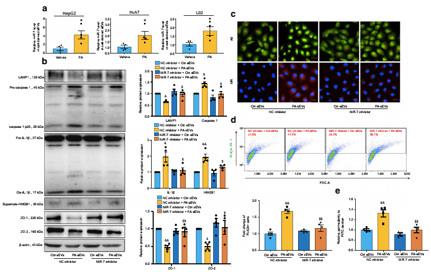 novel-miR-7的基因抑制可改善NAFLD肝源性外泌體誘導(dǎo)的微血管內(nèi)皮高通透性